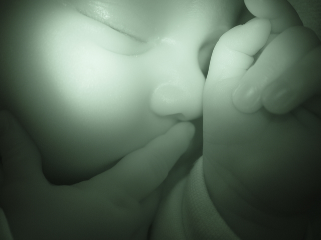 Zavarja-e a babát az ultrahang?