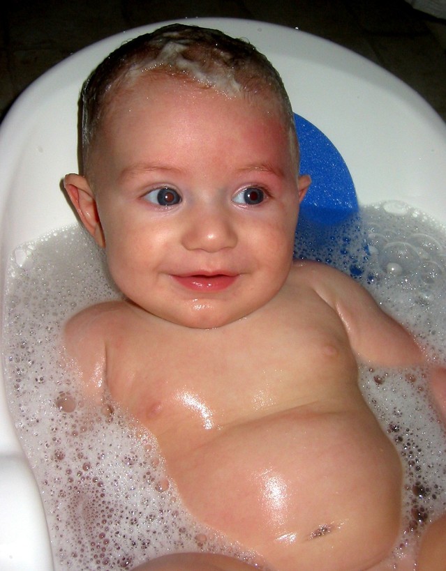 Ekcéma csecsemőkorban: a sok fürdés okozza?